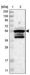 Zinc Finger Protein 200 antibody, PA5-53884, Invitrogen Antibodies, Western Blot image 