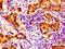Neuronal PAS Domain Protein 2 antibody, LS-C670804, Lifespan Biosciences, Immunohistochemistry paraffin image 