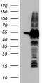 Histone-lysine N-methyltransferase SETD2 antibody, TA804268, Origene, Western Blot image 