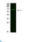 NUT Midline Carcinoma Family Member 1 antibody, LS-C814180, Lifespan Biosciences, Western Blot image 