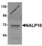 NLR Family Pyrin Domain Containing 10 antibody, 5967, ProSci, Western Blot image 