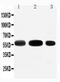 Solute Carrier Family 1 Member 1 antibody, GTX12393, GeneTex, Western Blot image 