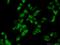 Serine/threonine-protein phosphatase PP1-gamma catalytic subunit antibody, 11082-1-AP, Proteintech Group, Immunofluorescence image 