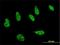 Homeodomain-interacting protein kinase 1 antibody, H00204851-M01, Novus Biologicals, Immunocytochemistry image 