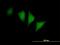 Cyclin-dependent kinase 14 antibody, H00005218-B01P, Novus Biologicals, Immunofluorescence image 