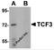 Transcription Factor 3 antibody, 5609, ProSci, Western Blot image 