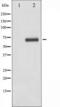 Ribosomal Protein S6 Kinase B1 antibody, TA325824, Origene, Western Blot image 