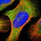 YARS antibody, HPA018954, Atlas Antibodies, Immunofluorescence image 