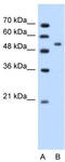 Perilipin A antibody, TA346328, Origene, Western Blot image 