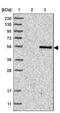 Peroxisomal leader peptide-processing protease antibody, NBP1-93484, Novus Biologicals, Western Blot image 