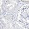 Chromosome 1 Open Reading Frame 87 antibody, NBP1-81101, Novus Biologicals, Western Blot image 