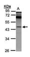 Retinoid-inducible serine carboxypeptidase antibody, GTX103381, GeneTex, Western Blot image 
