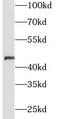 Zona Pellucida Glycoprotein 3 antibody, FNab09753, FineTest, Western Blot image 