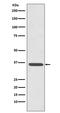 Annexin A2 antibody, M00868, Boster Biological Technology, Western Blot image 
