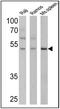 Human IgA antibody, PA5-16388, Invitrogen Antibodies, Western Blot image 