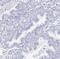 Collagen alpha-1(XVII) chain antibody, NBP1-91800, Novus Biologicals, Immunohistochemistry paraffin image 