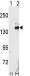 Proto-oncogene tyrosine-protein kinase receptor Ret antibody, AP14411PU-N, Origene, Western Blot image 