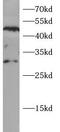N-Acetyltransferase 2 antibody, FNab10375, FineTest, Western Blot image 