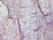 O-6-Methylguanine-DNA Methyltransferase antibody, A52416-100, Epigentek, Immunohistochemistry paraffin image 