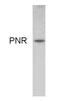 Pnr antibody, GTX79268, GeneTex, Western Blot image 