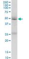 Formin-1 antibody, H00342184-M07, Novus Biologicals, Western Blot image 