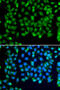 E3 ubiquitin-protein ligase RNF8 antibody, abx005509, Abbexa, Western Blot image 