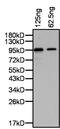 PR/SET Domain 14 antibody, PA1-114, Invitrogen Antibodies, Western Blot image 