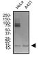 Survivin antibody, NBP2-59503, Novus Biologicals, Western Blot image 