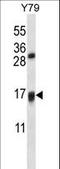 Vitamin K Epoxide Reductase Complex Subunit 1 Like 1 antibody, LS-C160532, Lifespan Biosciences, Western Blot image 