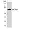 Sodium/hydrogen exchanger 6 antibody, LS-C200701, Lifespan Biosciences, Western Blot image 