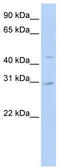 SLC10A4 antibody, TA333478, Origene, Western Blot image 
