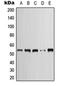 Keratin 7 antibody, orb214164, Biorbyt, Western Blot image 