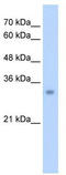 Enoyl-CoA Hydratase 1 antibody, TA332137, Origene, Western Blot image 