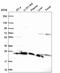 Ribosomal Protein S5 antibody, HPA061979, Atlas Antibodies, Western Blot image 