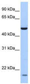 Zinc Finger Protein 764 antibody, TA341433, Origene, Western Blot image 