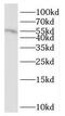 High mobility group nucleosome-binding domain-containing protein 5 antibody, FNab05862, FineTest, Western Blot image 