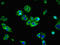 Solute Carrier Family 39 Member 8 antibody, LS-C672329, Lifespan Biosciences, Immunofluorescence image 