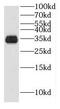 HUS1 Checkpoint Clamp Component B antibody, FNab04083, FineTest, Western Blot image 