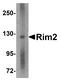 Regulating Synaptic Membrane Exocytosis 2 antibody, A09915-1, Boster Biological Technology, Western Blot image 