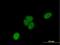 Uncharacterized protein C1orf103 antibody, H00055791-B01P, Novus Biologicals, Immunocytochemistry image 