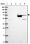 Zinc Finger Protein 891 antibody, NBP1-90894, Novus Biologicals, Western Blot image 