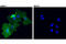 EGFR antibody, 71655S, Cell Signaling Technology, Immunocytochemistry image 