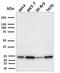 Secretoglobin Family 2A Member 2 antibody, AE00189, Aeonian Biotech, Western Blot image 