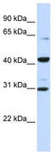 Zinc Finger And SCAN Domain Containing 9 antibody, TA339124, Origene, Western Blot image 