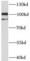Chromosome 3 Open Reading Frame 20 antibody, FNab01105, FineTest, Western Blot image 