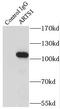 Endoplasmic Reticulum Aminopeptidase 1 antibody, FNab00616, FineTest, Immunoprecipitation image 