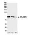 Denticleless protein homolog antibody, NB100-40840, Novus Biologicals, Western Blot image 