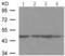 CD209 antigen antibody, TA323921, Origene, Western Blot image 