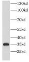 STA antibody, FNab02753, FineTest, Western Blot image 