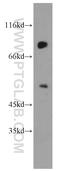 Ubiquitin carboxyl-terminal hydrolase 49 antibody, 18066-1-AP, Proteintech Group, Western Blot image 